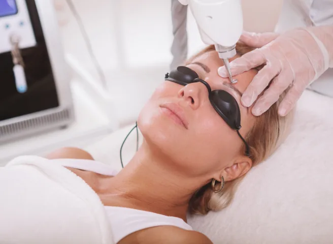 Laser eyebrow tattoo removal performed on a patient wearing protective eyewear