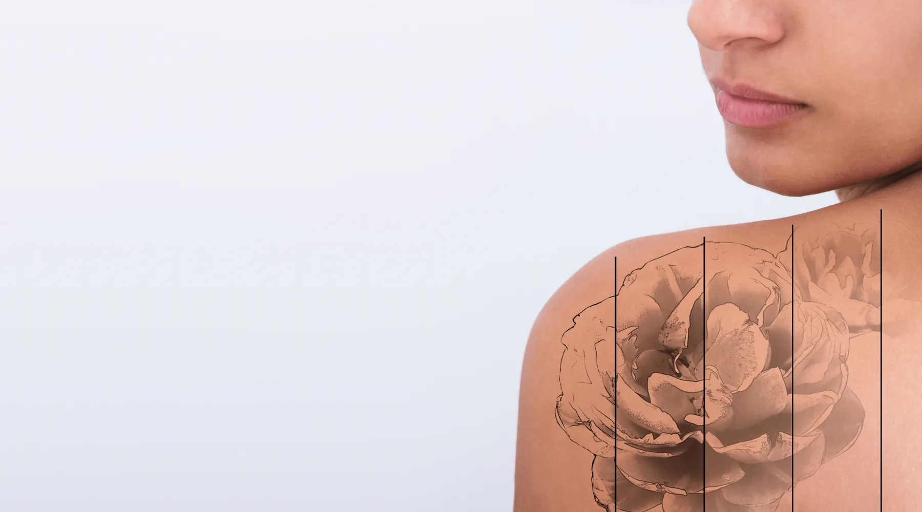 Shoulder tattoo lightening progressively across sessions